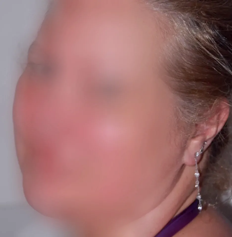 Linnéa, 28